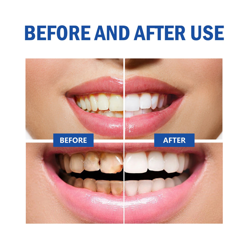Eelhoe Teeth Mousse Cleaner
