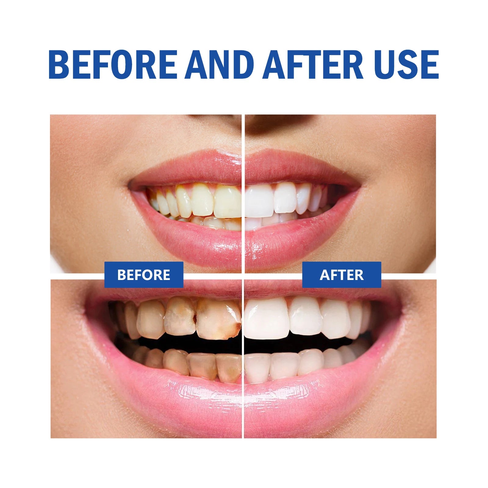 Eelhoe Teeth Mousse Cleaner