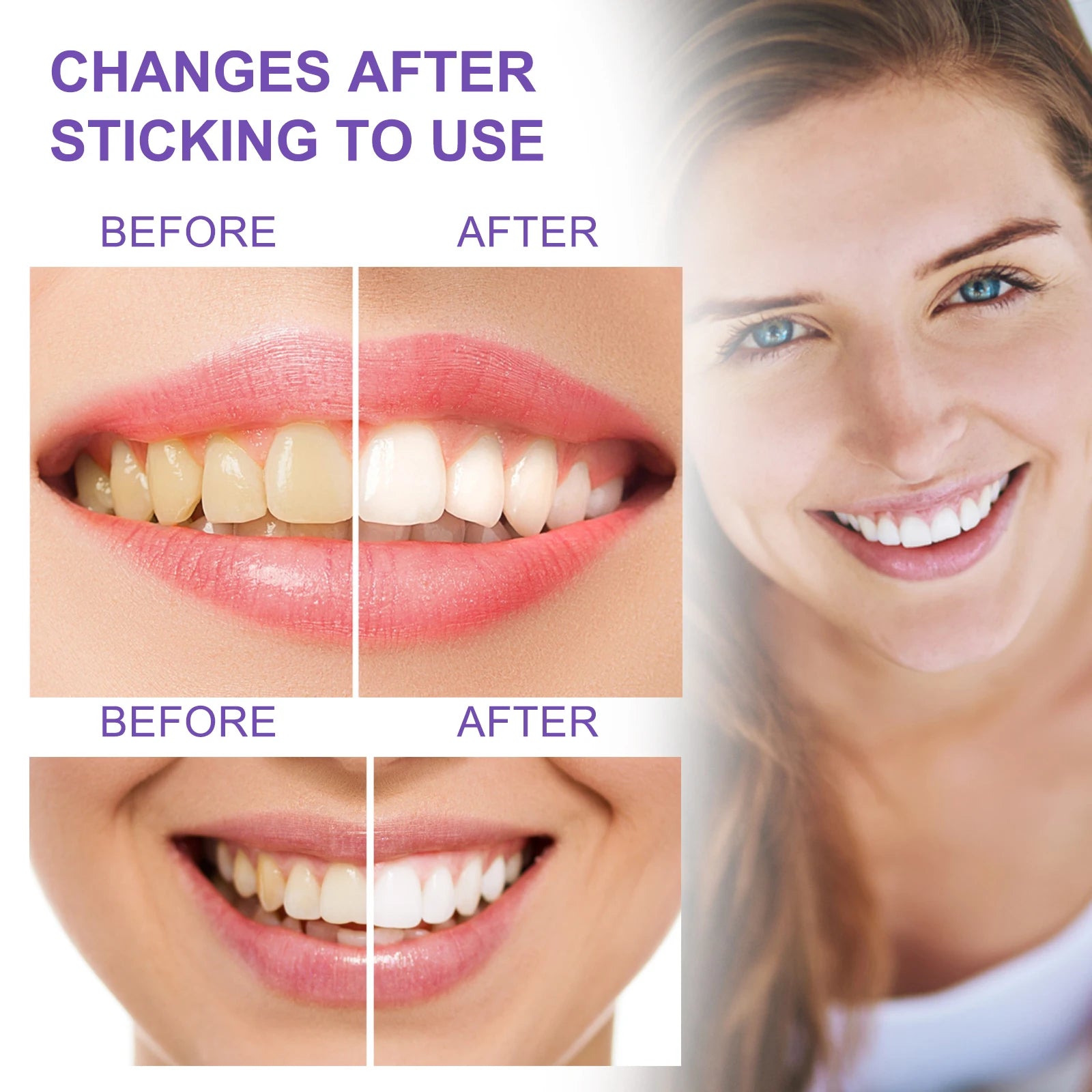 Eelhoe Stain Removal Toothpaste