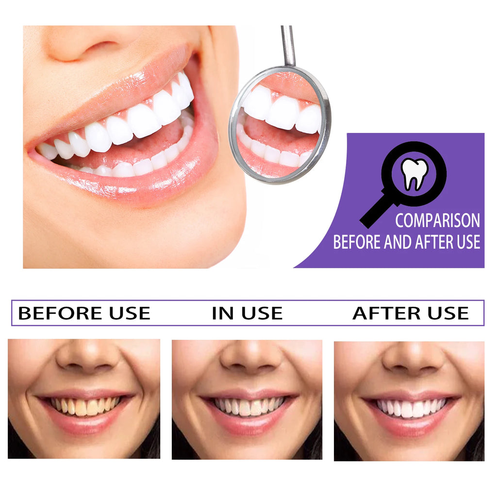 Eelhoe Stain Removal Toothpaste