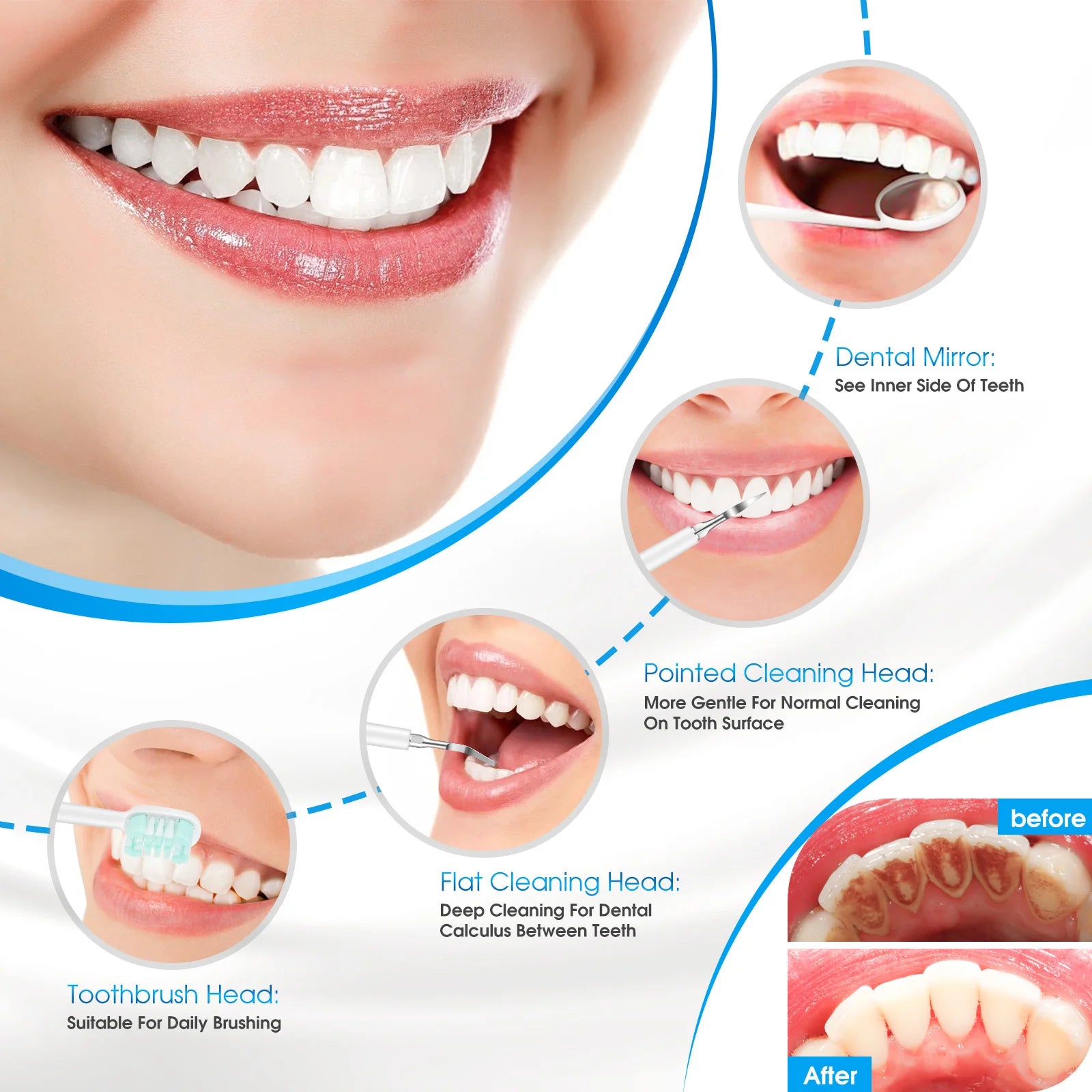 Whitening Kit Sonic Toothbrush