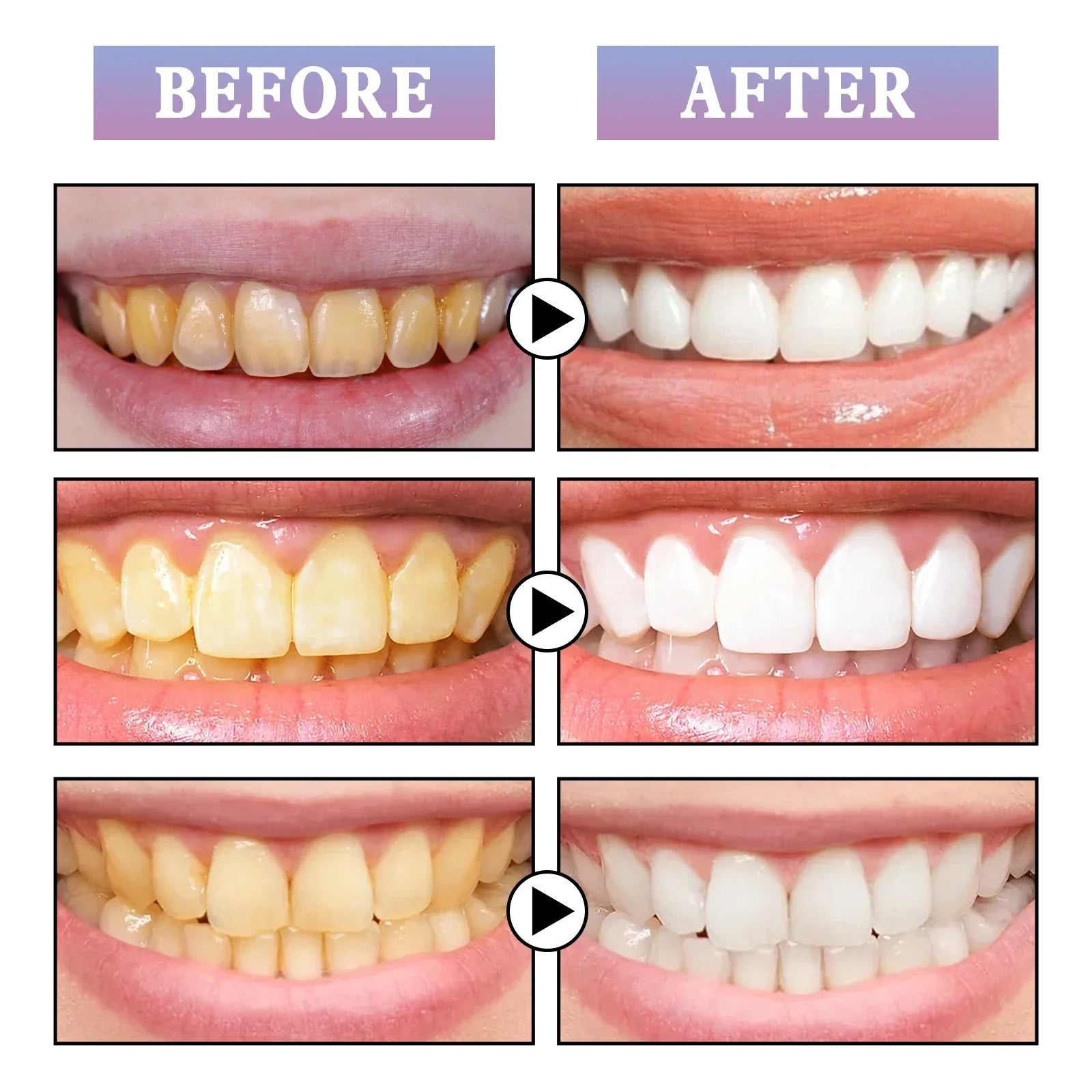 Teeth Whitening Paint Stick