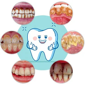 Whitening Kit Sonic Toothbrush
