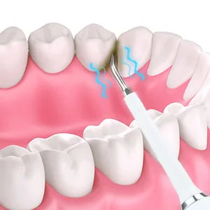 Whitening Kit Sonic Toothbrush